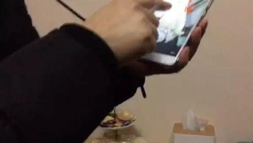 火疗视频全过程