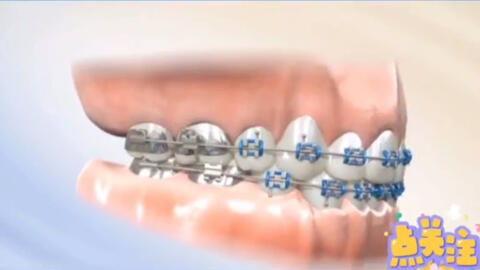 牙视频,揭秘口腔健康与美丽笑容的秘密