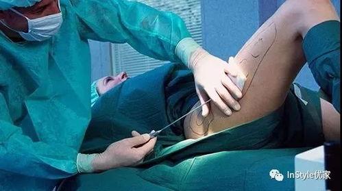 刮阴毛视频,时尚潮流下的私密护理新趋势