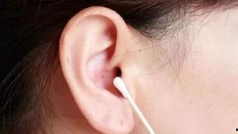 赵医生掏耵聍最难视频,惊险瞬间全程记录