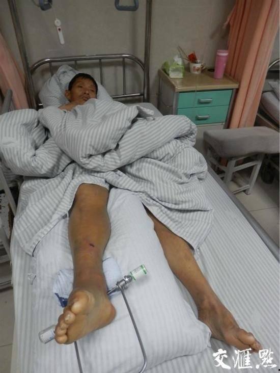 打小腿的视频,打小腿视频引发社会热议