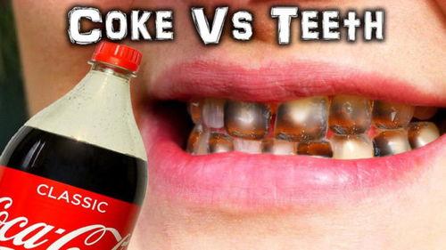 可乐泡牙齿试验视频,揭示碳酸饮料对牙齿的惊人破坏