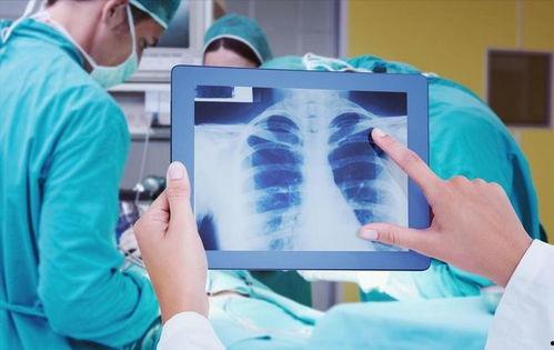 肺癌视频,病因、症状与防治策略