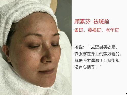 祛斑视频,跟随视频轻松告别斑点困扰